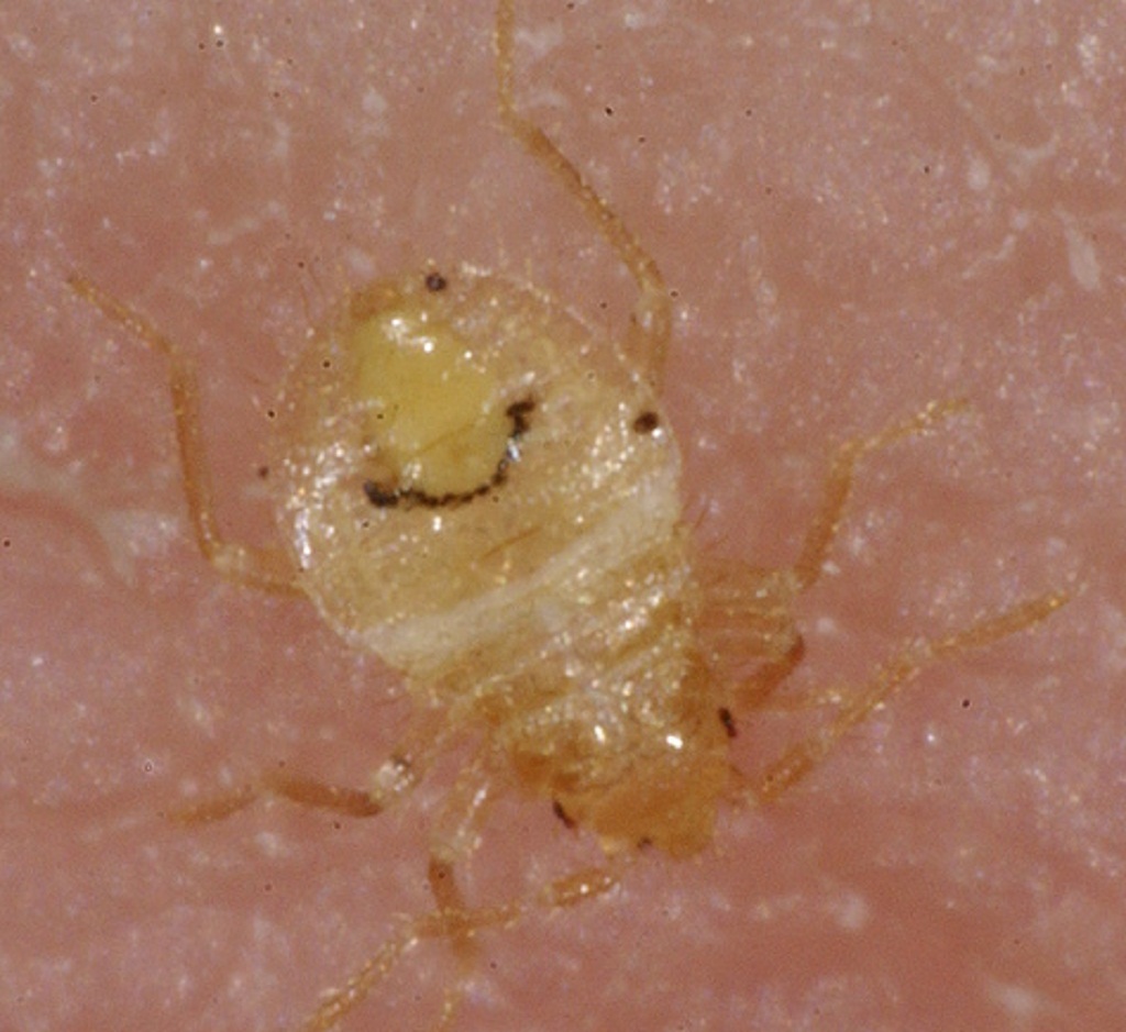 Bed Bugs Pictures Bed bug nymph picture â€“ BED BUG BITES and BED BUG ...
